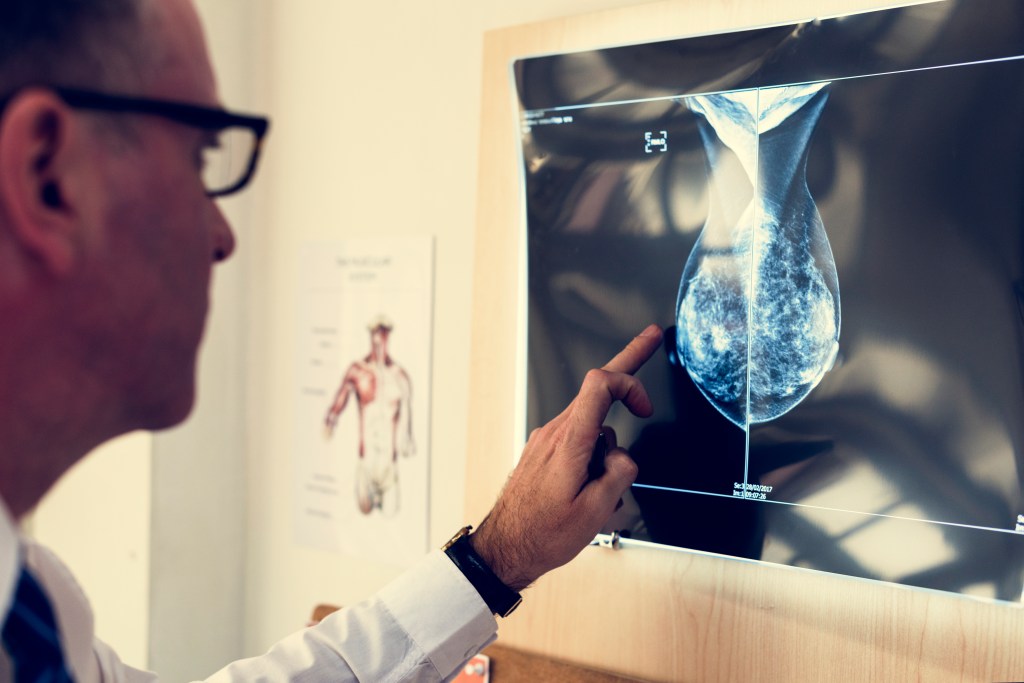 Lezyonlarımız büyüyor mu?